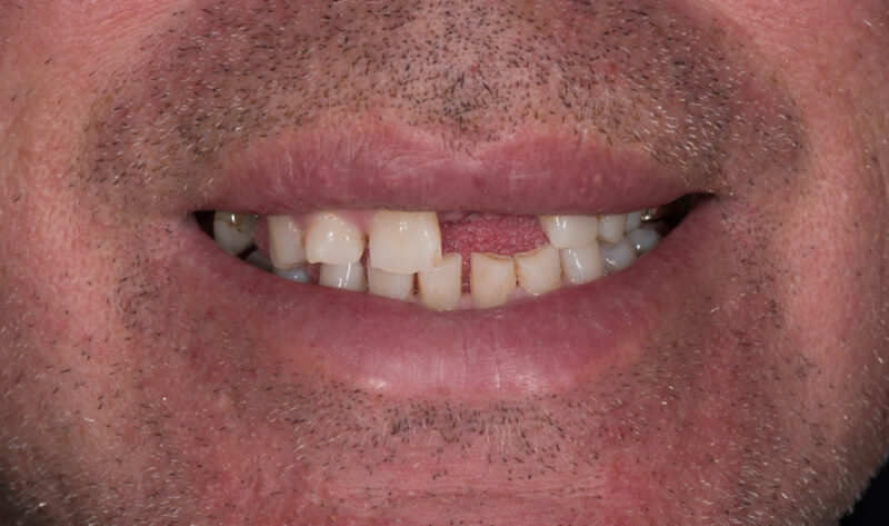 Before - Rowtree Dental Care